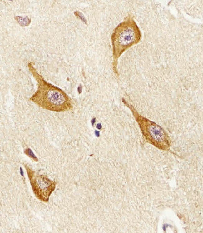 PIP4K2A / PIPK Antibody - Immunohistochemical of paraffin-embedded H. brain section using PIP4K2A antibody diluted at 1:25 dilution. A undiluted biotinylated goat polyvalent antibody was used as the secondary, followed by DAB staining.
