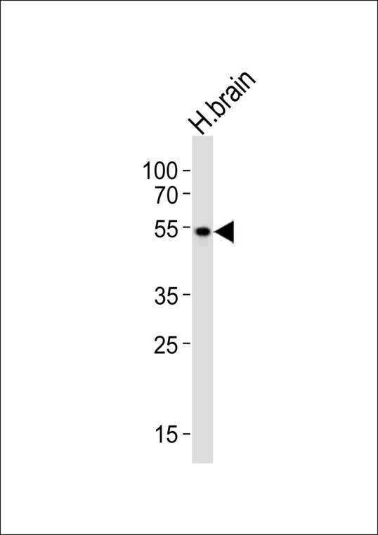 PIP4K2A / PIPK Antibody - Western blot of lysate from human brain tissue, using PIP4K2A antibody diluted at 1:1000. A goat anti-rabbit IgG H&L (HRP) at 1:10000 dilution was used as the secondary antibody. Lysate at 20 ug.