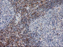 PIP4K2A / PIPK Antibody - IHC of paraffin-embedded Human lymph node tissue using anti-PIP4K2A mouse monoclonal antibody.