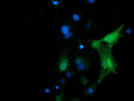 PIP4K2A / PIPK Antibody - Anti-PIP4K2A mouse monoclonal antibody immunofluorescent staining of COS7 cells transiently transfected by pCMV6-ENTRY PIP4K2A.
