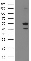 PIP4K2A / PIPK Antibody - HEK293T cells were transfected with the pCMV6-ENTRY control (Left lane) or pCMV6-ENTRY PIP4K2A (Right lane) cDNA for 48 hrs and lysed. Equivalent amounts of cell lysates (5 ug per lane) were separated by SDS-PAGE and immunoblotted with anti-PIP4K2A.