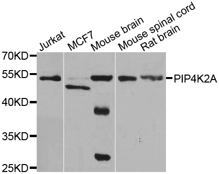 PIP4K2A / PIPK Antibody - Western blot analysis of extracts of various cell lines.