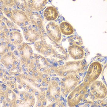 PIP4K2A / PIPK Antibody - Immunohistochemistry of paraffin-embedded rat kidney tissue.