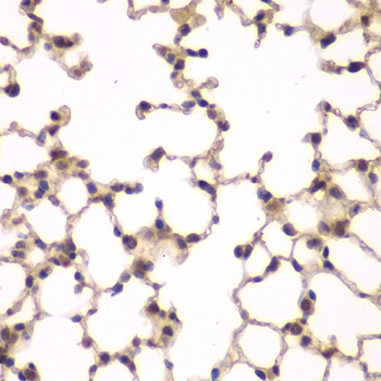 PIP4K2A / PIPK Antibody - Immunohistochemistry of paraffin-embedded mouse lung tissue.