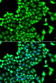 PIP4K2A / PIPK Antibody - Immunofluorescence analysis of A549 cells.