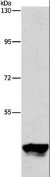 PIP4K2A / PIPK Antibody - Western blot analysis of K562 cell, using PIP4K2A Polyclonal Antibody at dilution of 1:950.