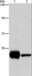 PIP4K2A / PIPK Antibody - Western blot analysis of K562 and mouse brain tissue, using PIP4K2A Polyclonal Antibody at dilution of 1:1150.