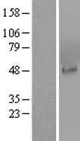 PIP4K2A / PIPK Protein - Western validation with an anti-DDK antibody * L: Control HEK293 lysate R: Over-expression lysate