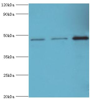 PIP4K2B Antibody - Western blot. All lanes: Phosphatidylinositol 5-phosphate 4-kinase type-2 beta antibody at 10 ug/ml. Lane 1: HeLa whole cell lysate. Lane 2: MCF-7 whole cell lysate. Lane 3: 293T whole cell lysate. secondary Goat polyclonal to rabbit at 1:10000 dilution. Predicted band size: 47 kDa. Observed band size: 47 kDa.