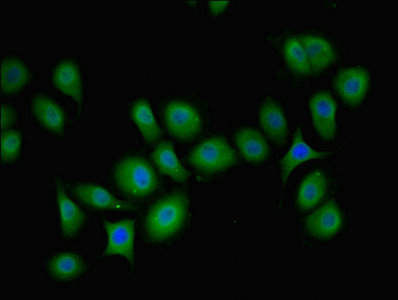 PIP4K2B Antibody - Immunofluorescent analysis of A549 cells using PIP4K2B Antibody at dilution of 1:100 and Alexa Fluor 488-congugated AffiniPure Goat Anti-Rabbit IgG(H+L)