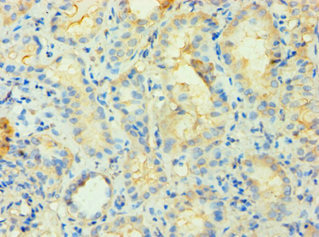 PIP4K2B Antibody - Immunohistochemistry of paraffin-embedded human kidney tissue using PIP4K2B Antibody at dilution of 1:100