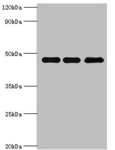 PIP4K2B Antibody - Western blot All lanes: Phosphatidylinositol 5-phosphate 4-kinase type-2 beta antibody at 10µg/ml Lane 1: Hela whole cell lysate Lane 2: MCF-7 whole cell lysate Lane 3: 293T whole cell lysate Secondary Goat polyclonal to rabbit IgG at 1/10000 dilution Predicted band size: 48, 33 kDa Observed band size: 48 kDa
