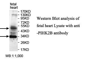 PIP4K2B Antibody