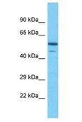 PIP4K2B Antibody - PIP4K2B antibody Western Blot of NCI-H226. Antibody dilution: 1 ug/ml.  This image was taken for the unconjugated form of this product. Other forms have not been tested.