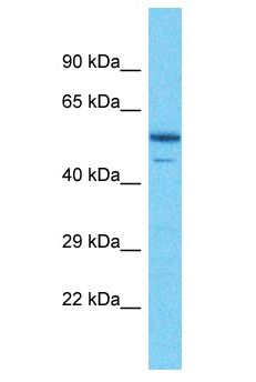 PIP4K2B Antibody - PIP4K2B antibody Western Blot of NCI-H226. Antibody dilution: 1 ug/ml.  This image was taken for the unconjugated form of this product. Other forms have not been tested.