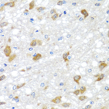 PIP4K2B Antibody - Immunohistochemistry of paraffin-embedded rat brain tissue.