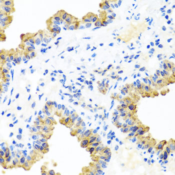 PIP4K2B Antibody - Immunohistochemistry of paraffin-embedded mouse lung tissue.