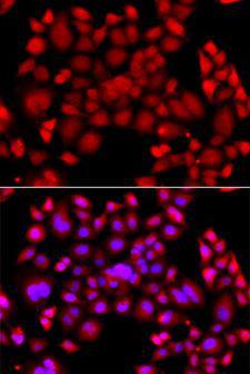 PIP4K2B Antibody - Immunofluorescence analysis of A549 cells using PIP4K2B antibody. Blue: DAPI for nuclear staining.