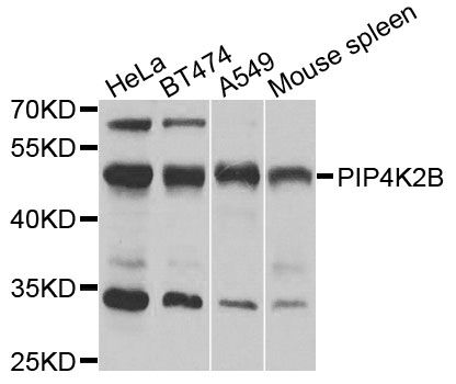 PIP4K2B Antibody - Western blot analysis of extracts of various cell lines, using PIP4K2B antibody at 1:1000 dilution. The secondary antibody used was an HRP Goat Anti-Rabbit IgG (H+L) at 1:10000 dilution. Lysates were loaded 25ug per lane and 3% nonfat dry milk in TBST was used for blocking. An ECL Kit was used for detection and the exposure time was 30s.