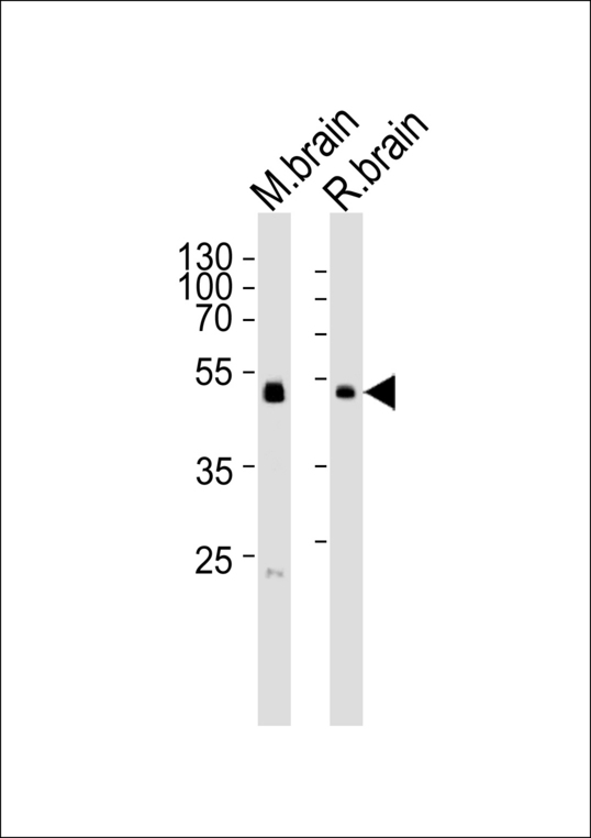 PIP4K2C Antibody - Western blot of lysates from mouse brain and rat brain tissue lysate (from left to right) with PIP4K2C Antibody. Antibody was diluted at 1:1000 at each lane. A goat anti-rabbit IgG H&L (HRP) at 1:5000 dilution was used as the secondary antibody. Lysates at 35 ug per lane.
