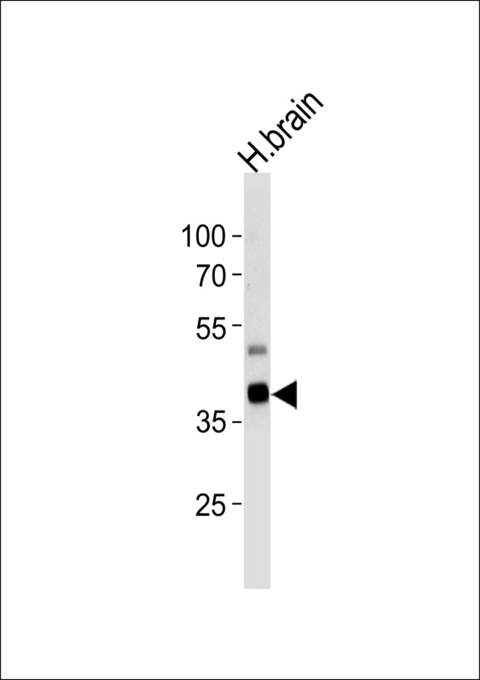 PIP4K2C Antibody - Western blot of lysate from human brain tissue lysate, using PIP5K2G Antibody(E348). Antibody was diluted at 1:1000 at each lane. A goat anti-rabbit IgG H&L (HRP) at 1:5000 dilution was used as the secondary antibody. Lysate at 35ug per lane.