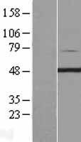PIP4K2C Protein - Western validation with an anti-DDK antibody * L: Control HEK293 lysate R: Over-expression lysate