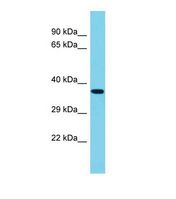 PIP5K1A Antibody - Western blot of Mouse Lung. Pip5k1a antibody dilution 1.0 ug/ml.  This image was taken for the unconjugated form of this product. Other forms have not been tested.