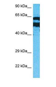 PIP5K1A Antibody - Western blot of PIP5K1A Antibody with human MCF7 Whole Cell lysate.  This image was taken for the unconjugated form of this product. Other forms have not been tested.