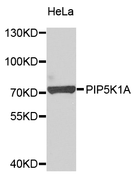 PIP5K1A Antibody - Western blot analysis of extracts of HeLa cells.
