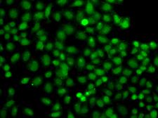 PIP5K1A Antibody - Immunofluorescence analysis of A549 cells.