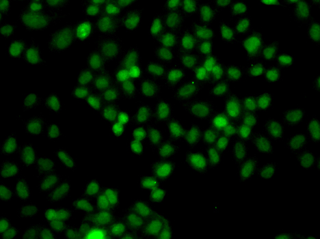 PIP5K1A Antibody - Immunofluorescence analysis of A549 cells.
