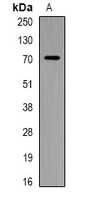 PIP5K1A Antibody - Western blot analysis of PIP5K1 alpha expression in HeLa (A) whole cell lysates.