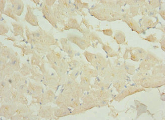 PIP5K1A Antibody - Immunohistochemistry of paraffin-embedded human heart tissue at dilution 1:100