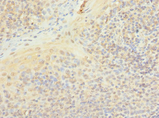 PIP5K1A Antibody - Immunohistochemistry of paraffin-embedded human tonsil tissue at dilution 1:100