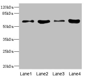 PIP5K1A Antibody - Western blot All Lanes: PIP5K1A antibody at 4.12ug/ml Lane 1: Hela whole cell lysate Lane 2: A431 whole cell lysate Lane 3: Mouse heart tissue Lane 4: Mouse kidney tissue Secondary Goat polyclonal to Rabbit IgG at 1/10000 dilution Predicted band size: 63,57,62,59 kDa Observed band size: 63 kDa