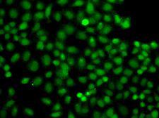 PIP5K1A Antibody - Immunofluorescence analysis of A549 cells using PIP5K1A antibody.