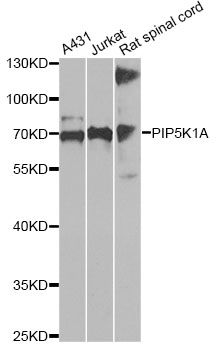 PIP5K1A Antibody - Western blot analysis of extracts of various cell lines, using PIP5K1A antibody at 1:1000 dilution. The secondary antibody used was an HRP Goat Anti-Rabbit IgG (H+L) at 1:10000 dilution. Lysates were loaded 25ug per lane and 3% nonfat dry milk in TBST was used for blocking. An ECL Kit was used for detection and the exposure time was 90s.