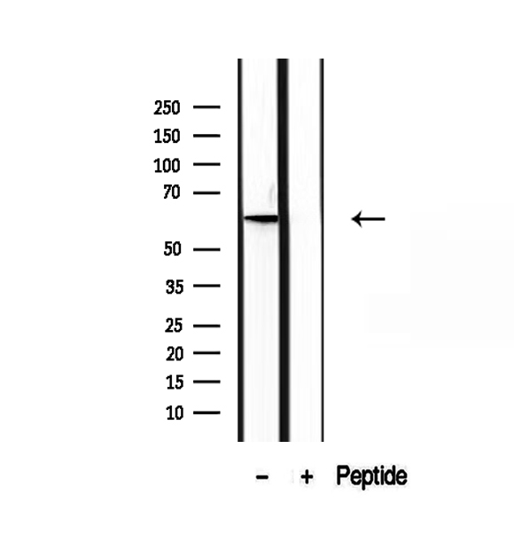 PIP5K1A Antibody - Western blot analysis of extracts of human liver tissue using PIP5K1A antibody.