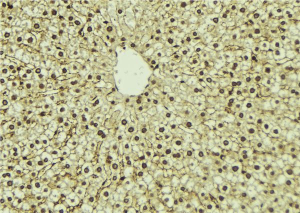 PIP5K1A Antibody - 1:100 staining mouse liver tissue by IHC-P. The sample was formaldehyde fixed and a heat mediated antigen retrieval step in citrate buffer was performed. The sample was then blocked and incubated with the antibody for 1.5 hours at 22°C. An HRP conjugated goat anti-rabbit antibody was used as the secondary.