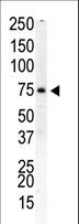 PIP5K1B Antibody - Western blot of anti-PIP5K1B antibody in human placenta cell lysate. PIP5K1B (arrow) was detected using purified antibody. Secondary HRP-anti-rabbit was used for signal visualization with chemiluminescence.