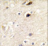 PIP5K1B Antibody - Formalin-fixed and paraffin-embedded human brain tissue reacted with PIP5K1B antibody , which was peroxidase-conjugated to the secondary antibody, followed by DAB staining. This data demonstrates the use of this antibody for immunohistochemistry; clinical relevance has not been evaluated.