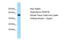 PIP5K1B Antibody -  This image was taken for the unconjugated form of this product. Other forms have not been tested.