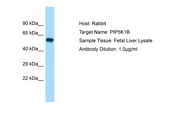 PIP5K1B Antibody -  This image was taken for the unconjugated form of this product. Other forms have not been tested.