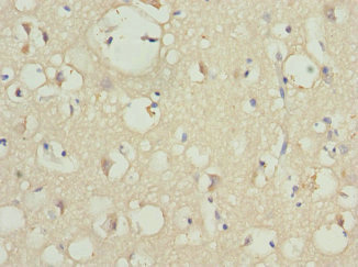 PIP5K1B Antibody - Immunohistochemistry of paraffin-embedded human brain tissue at dilution 1:100
