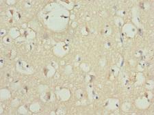 PIP5K1B Antibody - Immunohistochemistry of paraffin-embedded human brain tissue at dilution 1:100