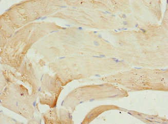 PIP5K1B Antibody - Immunohistochemistry of paraffin-embedded human skeletal muscle tissue at dilution 1:100