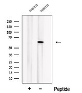 PIP5K1B Antibody - Western blot analysis of extracts of mouse testis tissue using PIP5K1B antibody. The lane on the left was treated with blocking peptide.