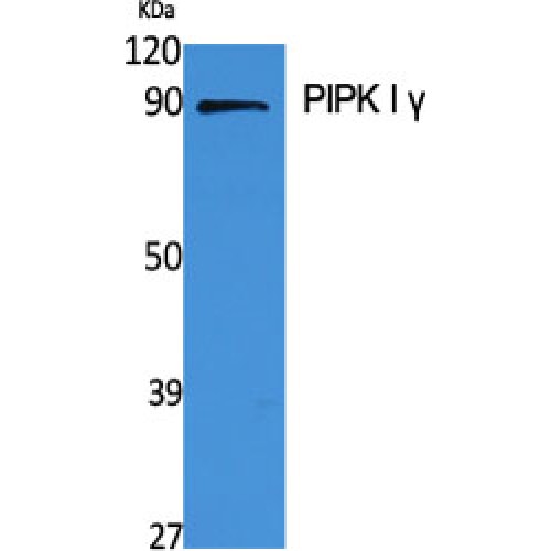 PIP5K1C Antibody - Western blot of PIPK I gamma antibody
