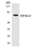 PIP5K1C Antibody - Western blot analysis of the lysates from HepG2 cells using PIP5K1C antibody.