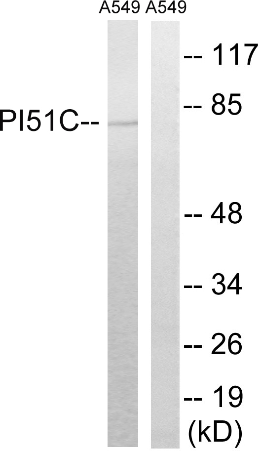 PIP5K1C Antibody - Western blot analysis of lysates from A549 cells, using PIP5K1C Antibody. The lane on the right is blocked with the synthesized peptide.